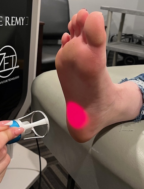 Class IV laser therapy on a foot
